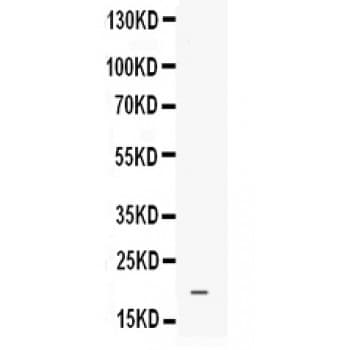 PROK1 / EG-VEGF Antibody (aa20-105)