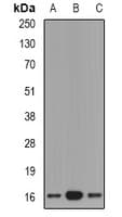 Polyclonal Rabbit anti-Human Gastrin Releasing Peptide Antibody (WB)