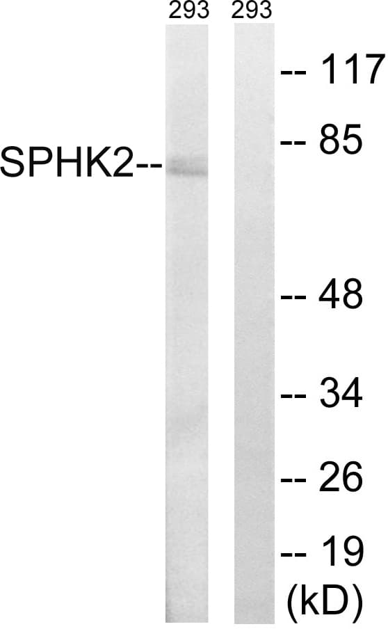 SPHK2 Antibody (aa580-629)