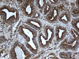 EPHX1 / Epoxide Hydrolase 1 Antibody (aa21-230, clone OTI3F11, Carrier-free)