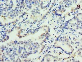 FOSL2 / FRA-2 Antibody (aa187-326)