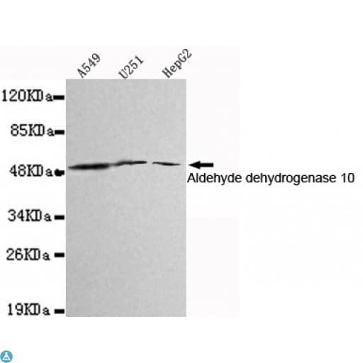 ALDH3A2 Antibody