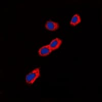 Polyclonal Rabbit anti-Human GIPR / GIP Receptor Antibody (Internal, IHC, IF, WB)