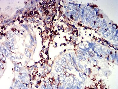 ADGRE5 / CD97 Antibody (clone 6D7E6)