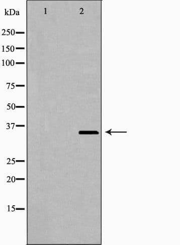 NUDT6 Antibody
