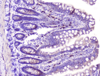 RASAL1 / RASAL Antibody