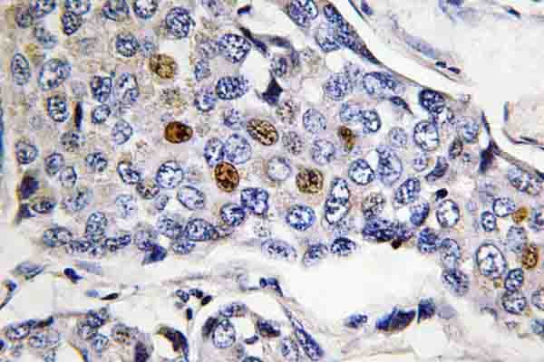 POLR3A Antibody (Pro68)