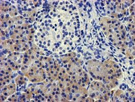 LPL / Lipoprotein Lipase Antibody (clone OTI5C6)