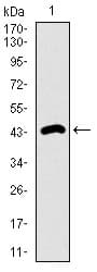 Monoclonal Mouse anti-Human DNAL4 / Dynein Light Chain 4 Antibody (clone 3B7B7, aa1-105, WB)