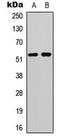 IHC-plus™ TP53 / p53 Antibody (phospho-Ser20)