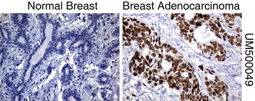 TP53 / p53 Antibody (clone UMAB55)