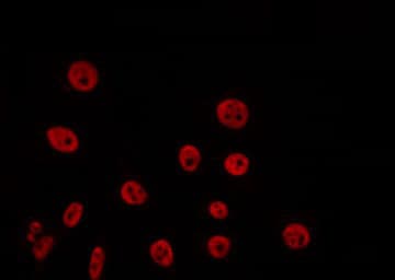 Polyclonal Rabbit anti-Human SAE2 / UBA2 Antibody (IHC, IF, WB)