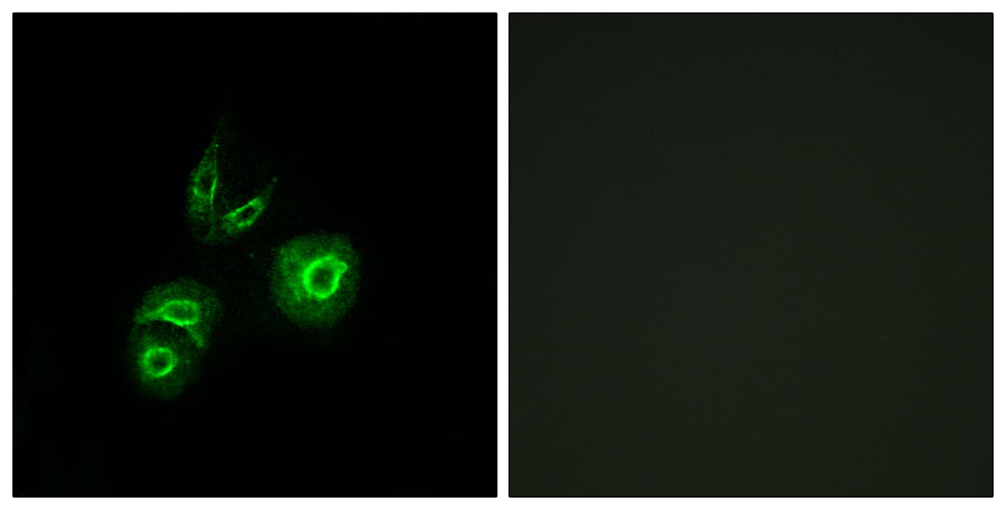 c-Met Antibody (aa276-325)