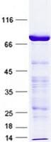 Human GBA / Glucosidase Beta Acid Protein (Recombinant GST, N-terminus + His, C-terminus)