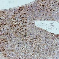 Monoclonal Mouse anti-Human Alpha-Fetoprotein Antibody (IHC, WB)