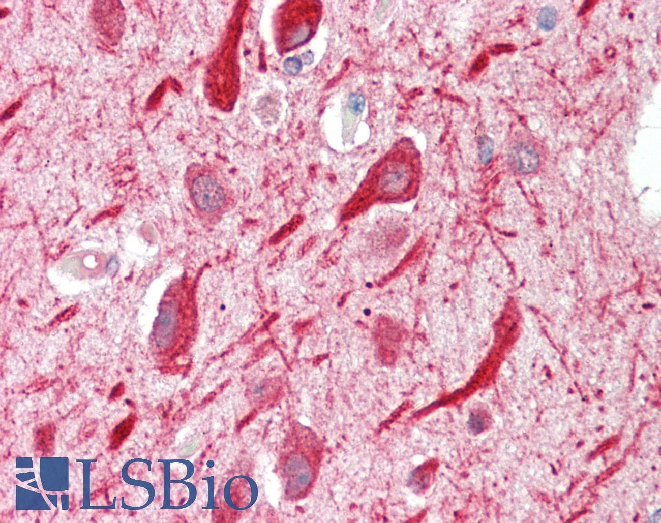 IHC-plus™ PPP2R5A Antibody (aa473-486)
