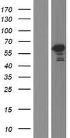 TBC1D22B Protein (Over-Expression Lysate Myc-DDK (Flag))