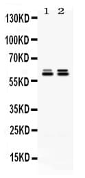 CCT5 / TCP1 Epsilon Antibody