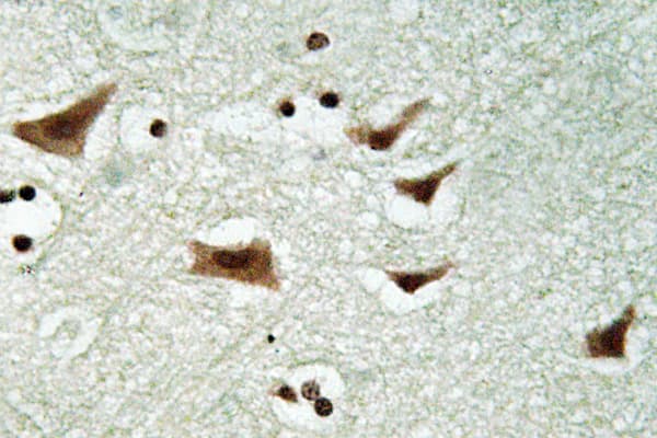 Polyclonal Rabbit anti-Human EIF4E Antibody (phospho-Ser209, IHC, WB)