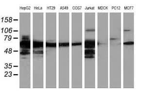 IHC-plus™ ERGIC-53 / LMAN1 Antibody (clone 2B10)
