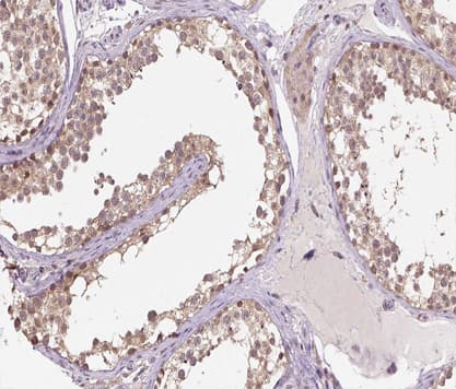 HSPH1 / HSP105 Antibody
