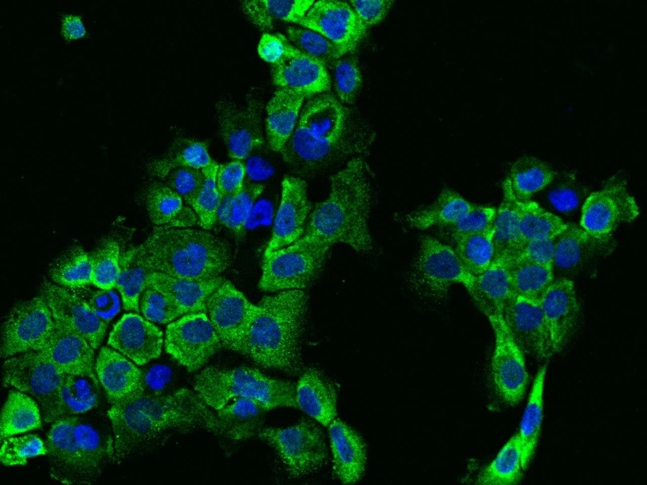 Polyclonal Rabbit anti-Human IFT122 / WDR10 Antibody (IHC, IF)