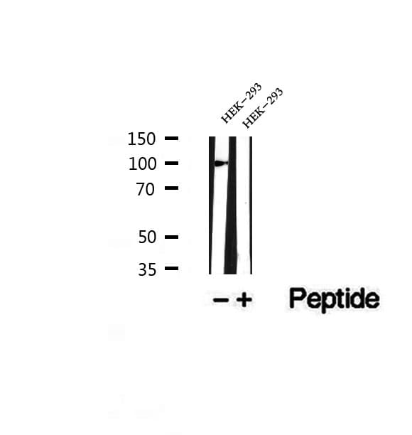 Polyclonal Rabbit anti-Human CTNNA3 / Alpha-3 Catenin Antibody (IHC, WB)