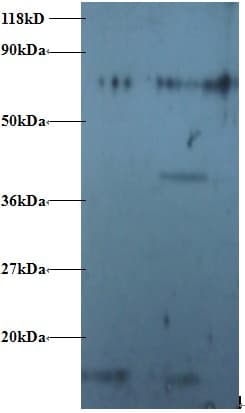 Polyclonal Rabbit anti-Human RPS16 / Ribosomal Protein S16 Antibody (Biotin, IHC, WB)