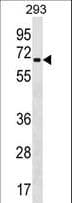 ZNF426 Antibody (aa234-260)
