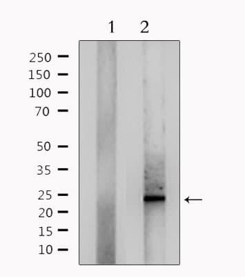 Polyclonal Rabbit anti-Human RANBP1 Antibody (WB)