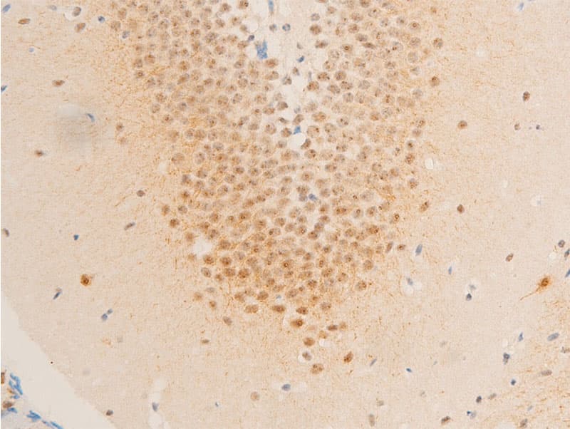 BIRC5 / Survivin Antibody (phospho-Thr117)