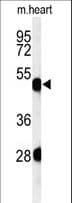 Polyclonal Rabbit anti-Human KRT82 / Keratin 82 / KRTHB2 Antibody (aa312-341, IHC, WB)