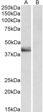 IHC-plus™ Polyclonal Goat anti-Human SERPINB1 Antibody (aa130-143, IHC, WB)