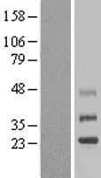 TMEM38B Protein (Over-Expression Lysate Myc-DDK (Flag))