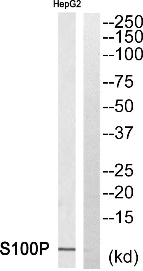 S100P Antibody