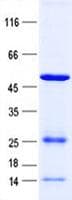 Human DTNBP1 / Dysbindin Protein (Recombinant His, N-Terminal)