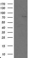Monoclonal Mouse anti-Human SKIL / SNO / SnoN Antibody (clone OTI3A7, WB)