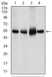 SLC2A4 / GLUT-4 Antibody (aa224-353, clone 3G10A3)