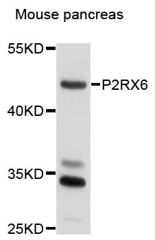 P2RX6 / P2X6 Antibody