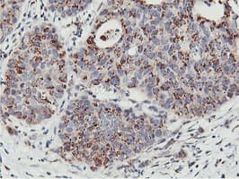 NMT2 Antibody (clone OTI1G3)