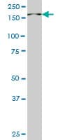 Monoclonal Mouse anti-Human PIK3C2B Antibody (clone 1H4, WB)