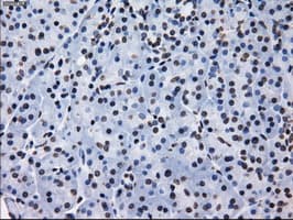 RPA2 / RFA2 / RPA34 Antibody (clone OTI8B3)