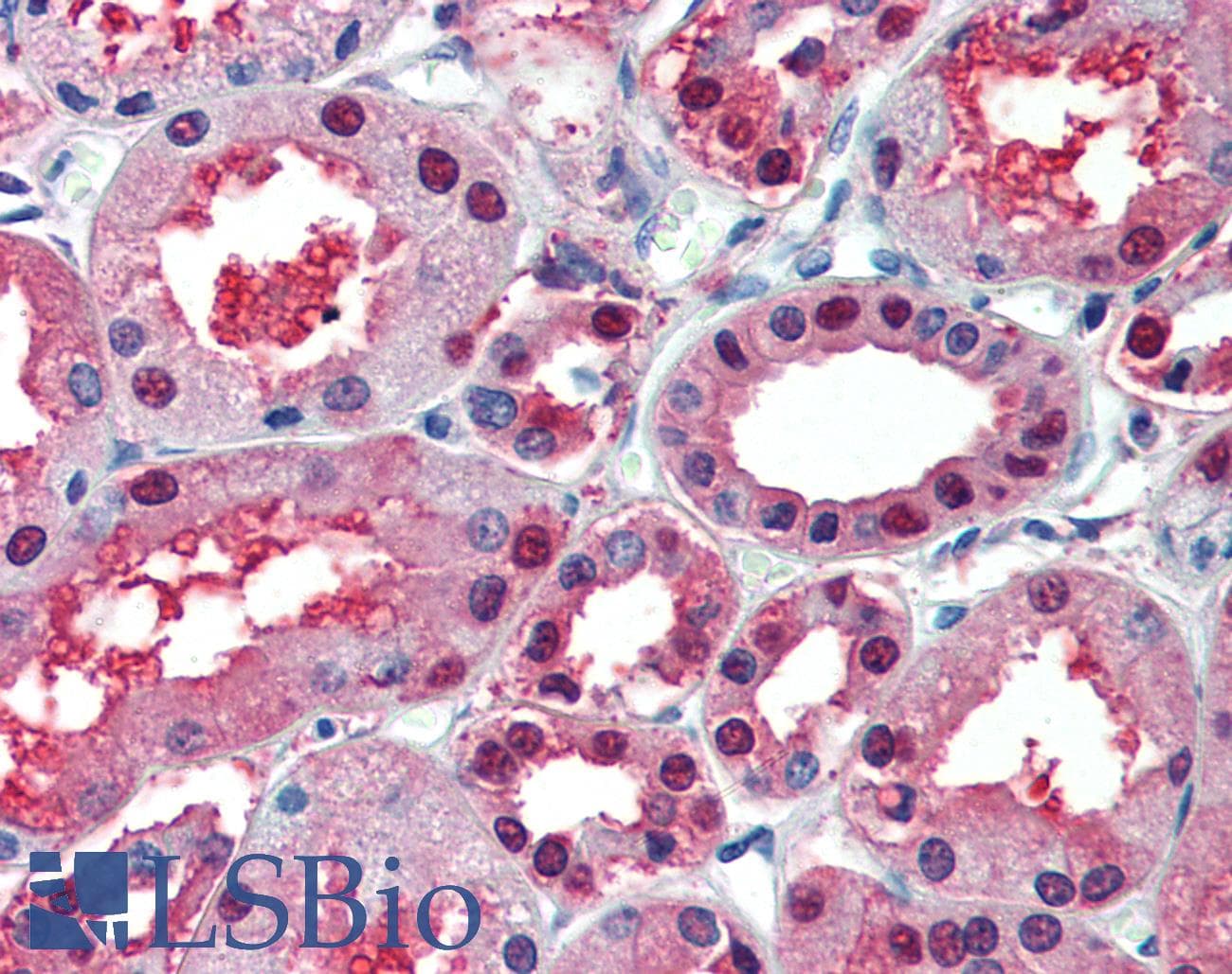 PathPlus™ Polyclonal Rabbit anti-Human ENO1 / Alpha Enolase Antibody (aa246-295, IHC, WB)