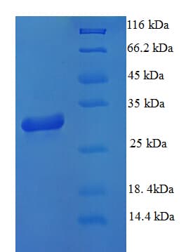 Human MAP1S Protein (Recombinant His)