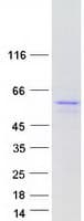 Human CHEK1 / CHK1 Protein (Recombinant Myc-DDK (Flag))