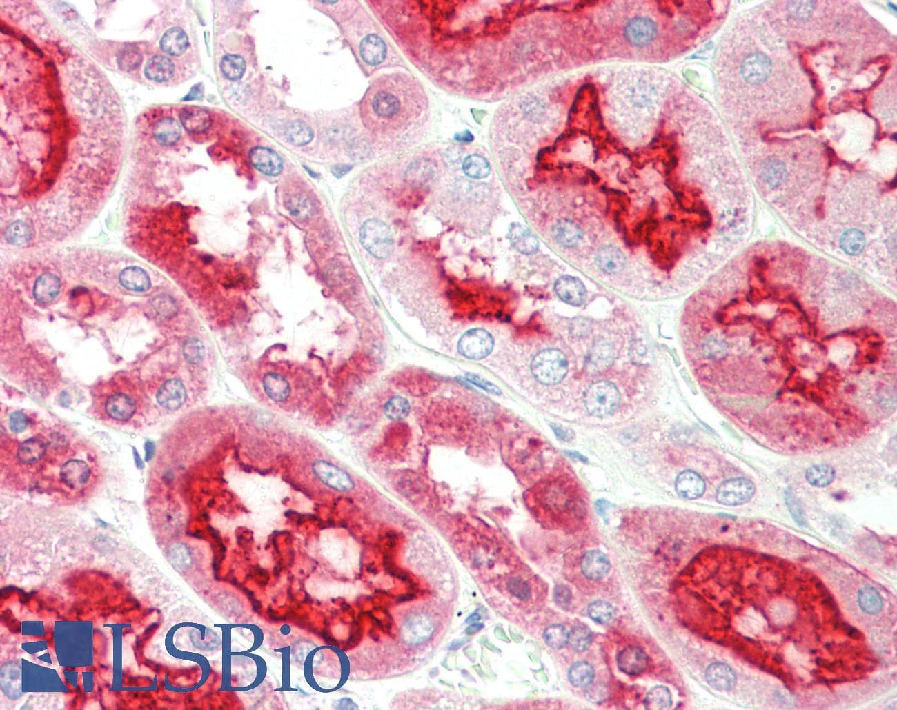 PathPlus™ Polyclonal Goat anti-Human KLK6 / Kallikrein 6 Antibody (aa145-156, IHC)