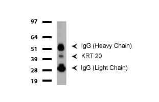 Monoclonal Mouse anti-Human KRT20 / CK20 / Cytokeratin 20 Antibody (clone UMAB167, Carrier-free, IHC, WB)