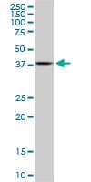 MAPKAPK3 Antibody (clone 2B5)