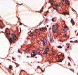 Polyclonal Rabbit anti-Human MAGEA9 Antibody (aa171-198, IHC, WB)