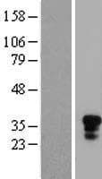 KLRB1 / CD161 Protein (Over-Expression Lysate Myc-DDK (Flag))